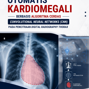 PENDETEKSIAN OTOMATIS KARDIOMEGALI: Berbasis Algoritma Cerdas Convolutional Neural Networks (CNN) Pada Pencitraan Digital Radiography Thorax